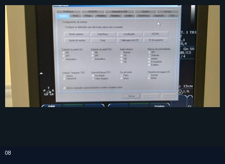 Foto real de configuração técnica em equipamento médico